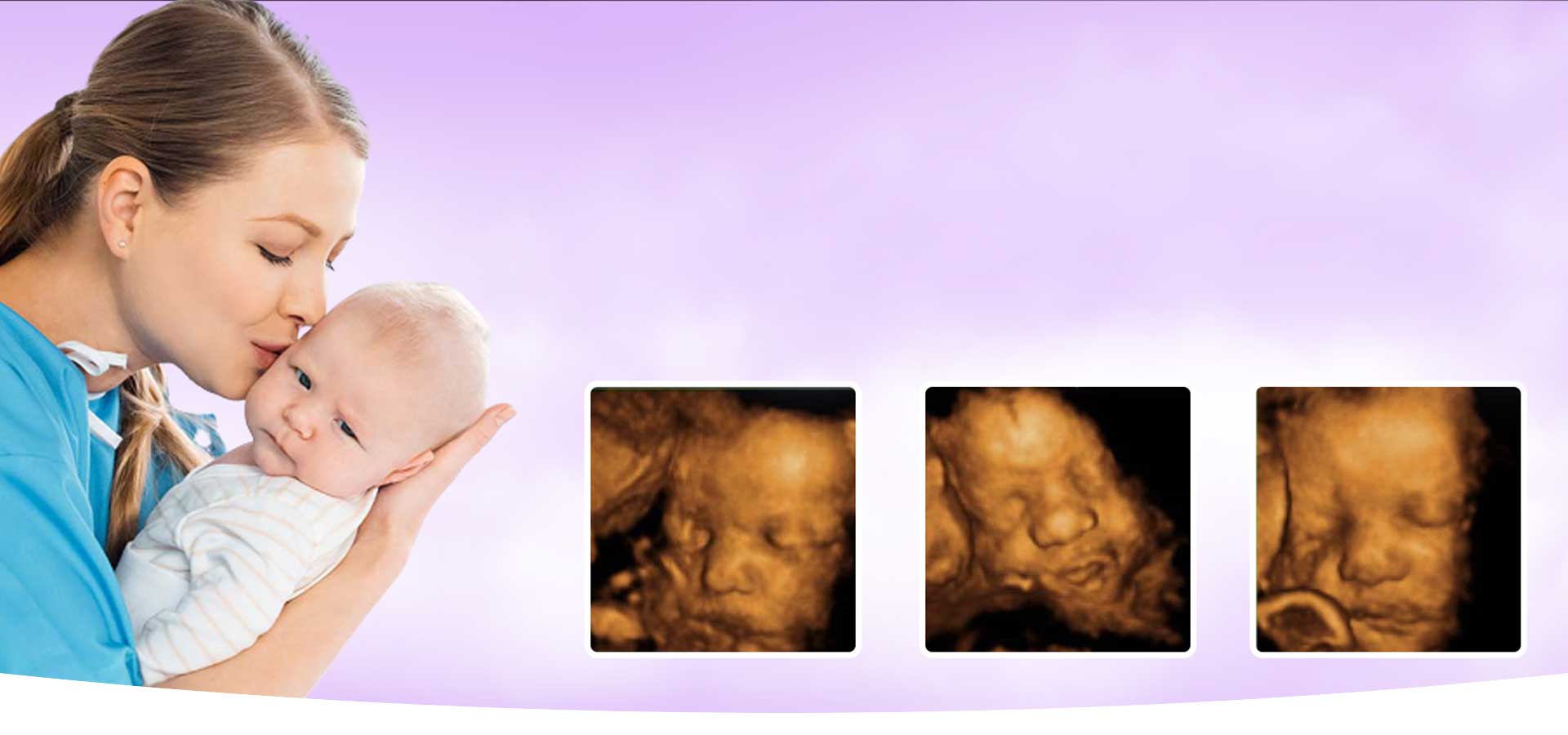 Little Angels 3D/4D – 3D/4D Ultrasound Imaging